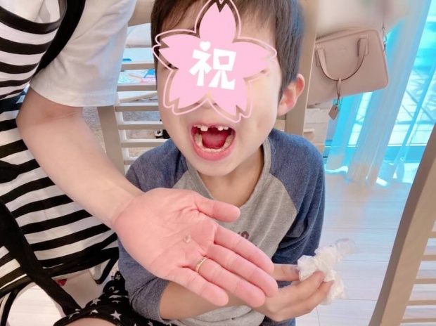 辻希美、息子の抜けた歯の写真を公開し批判殺到「生々しい画像見せないで」