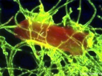 プラスチックを食べる海生菌類が発見される