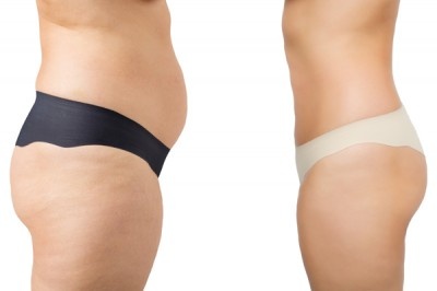 はい、アウト～！　「おデブ」と「ぽっちゃり」の境界線4つ