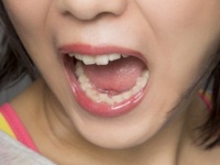 クセッ!!　男性が「口がくさい女性」とは絶対したくないこと6つ