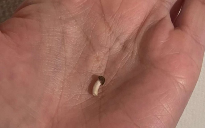 しめじ（画像はトリミング、あんちゃん＠annecharoさん提供）