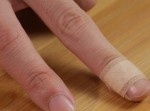 これで大丈夫！　絆創膏を剥がれにくくする方法
