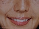 ゲゲッ！　有村架純がシミだらけの“５５歳”に老化…