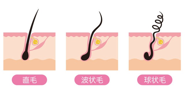 くせ毛・縮毛