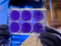 細菌の持つ酵素を分離させ、空気中の水素から電気をつくることに成功。未来の空気発電装置に
