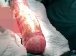 【アナニー】４５ｃｍの芋が肛門から抜けなくなった男性の悲劇…