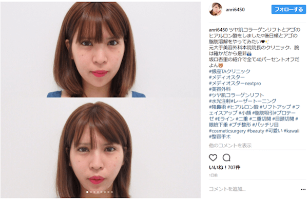 プチ整形告白の坂口杏里に続くか 奇行癖で不安視される 朝ドラ女優 デイリーニュースオンライン