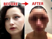 朝起きたら異星人！？自宅でのヘアカラーはパッチテストを十分に行わないと大変なことになる件