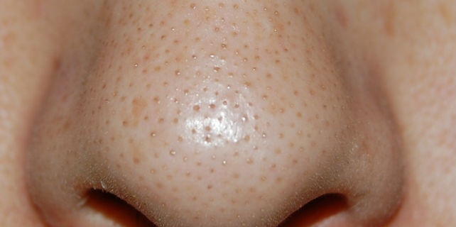 「Doctors Me（ドクターズミー）」コラム画像