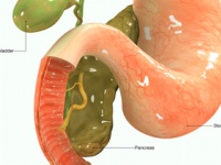 「膵がん」の早期発見につながる血液検査「マルチプレックスプラズモンアッセイ」を開発（depositphotos.com）