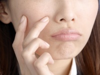 ナイナイ矢部　上京してストレスで皮膚病発症。慣れるまでに10年かかった