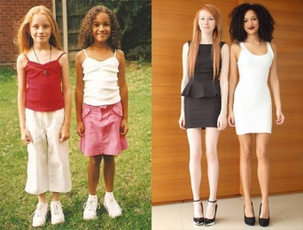 見た目も性格も完全に異なる双子姉妹。二人種誕生はどうやって起こる？（イギリス）