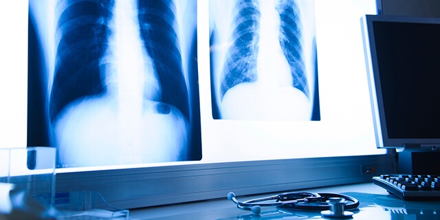 「Doctors Me（ドクターズミー）」コラム画像