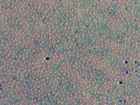 地面を覆いつくすほどの無数の輪。西オーストラリアで、フェアリー・サークル（妖精の輪）が発見される。※トライポフォビア注意