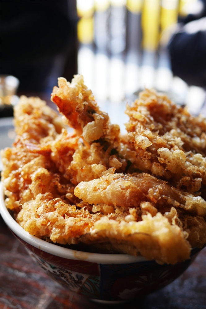 tendon5