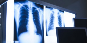 「Doctors Me（ドクターズミー）」コラム画像