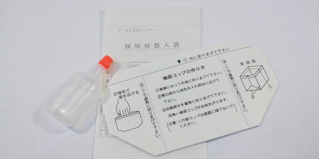 尿検査
