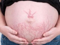 “妊娠線”を見たとき!?　夫が妻に冷める瞬間7　「授乳のためにどこでも乳を……」