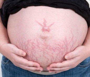 “妊娠線”を見たとき!?　夫が妻に冷める瞬間7　「授乳のためにどこでも乳を……」