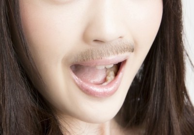 ヒゲ生えてんじゃん！　男性が「キスして後悔した女性」の特徴・6選