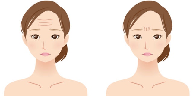 額と眉間のシワがある女性