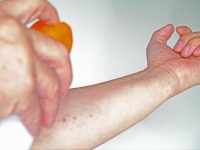 かゆ～い蚊、刺されないためにはどうすれば？　アース製薬に聞く「正しい蚊よけの使い方」