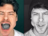 数年顎を鍛え続けるとどうなるのか？エラが超発達した男性モデルのビフォア・アフター（イタリア）