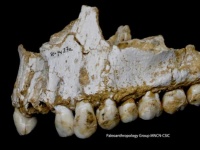 ネアンデルタール人の歯から抗生物質・鎮痛剤・ベジタリアン食の痕跡が発見される