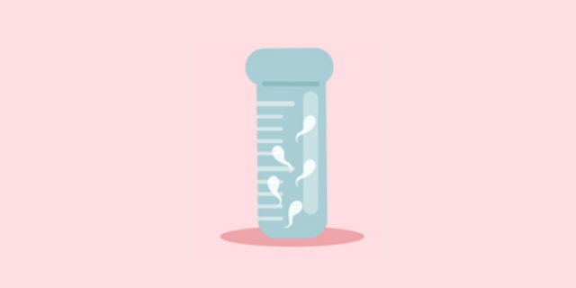 精子採取