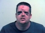 猛烈な反撃を受けたレイプ未遂容疑者、ボコボコにされながら御用！