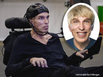 【RIP】世界初のサイボーグにチャレンジしたロボット博士が死去