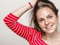 皮膚科医に聞く！　そばかすを消す方法ってあるの？