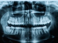 歯科治療のX線写真は3年間、保存されている（shutterstock.com）