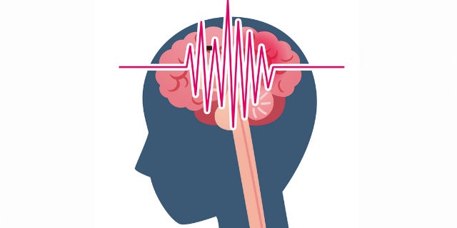 脳の異常