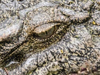何かを食べると涙が流れる「ワニの涙症候群」の男性