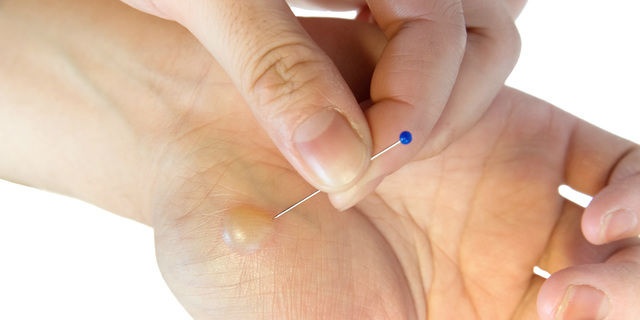 「Doctors Me（ドクターズミー）」コラム画像