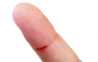 なぜ紙で指を切るとこんなにも痛いのか？
