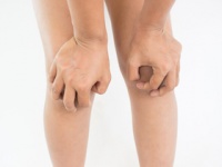 脚気を発症すると膝の下を叩いても下肢が反応しなくなり、ビタミンB1欠乏による心不全に（depositphotos.com）