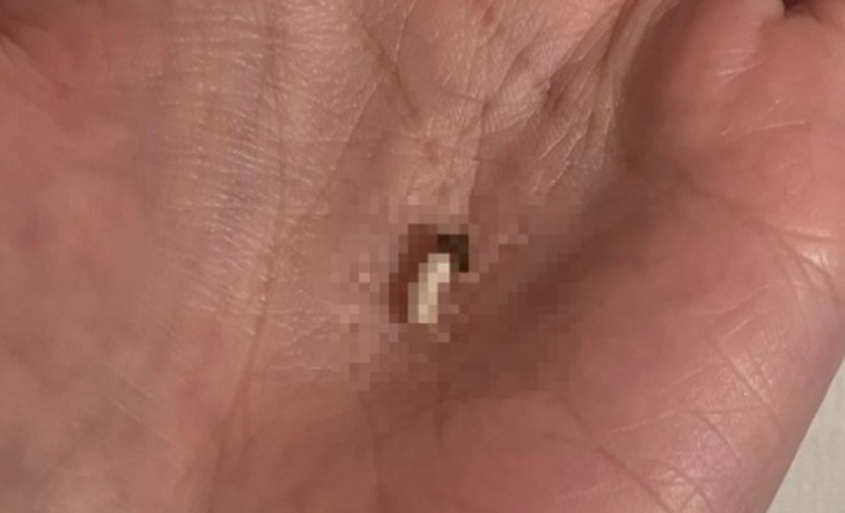 「髪に芋けんぴよりレアケース」　夫が髪から取ってくれた〝まさかの物体〟に24万人爆笑