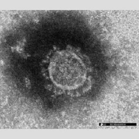 「コロナは永久に終息しない」衝撃報告（1）崩れ去った集団免疫シナリオ