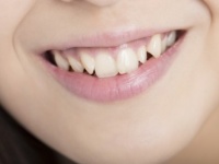 ぶっちゃけ、「口がくさそうな人」の特徴・6つ