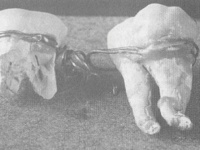 古代から中世にかけて発達していった、ちょっと怖い歯科治療に関する10の歴史