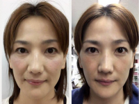 株式会社バランス　のプレスリリース画像