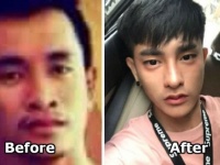 K-POPスターにあこがれて30回に及ぶ整形を繰り返したタイ人男性のビフォア・アフター