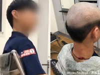 「外に出るのが恥ずかしくなる髪型にしてください」コロナ感染者急増中の台湾で母親が息子を波平ヘアに