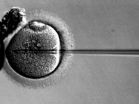顕微授精で精子を卵子に注入している様子（「Wikipedia」より）
