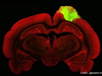 ラットに移植した人間のミニ脳が見事に結合。視覚刺激に反応