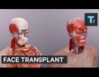 アメリカで行われた、史上最も複雑な顔面移植手術
