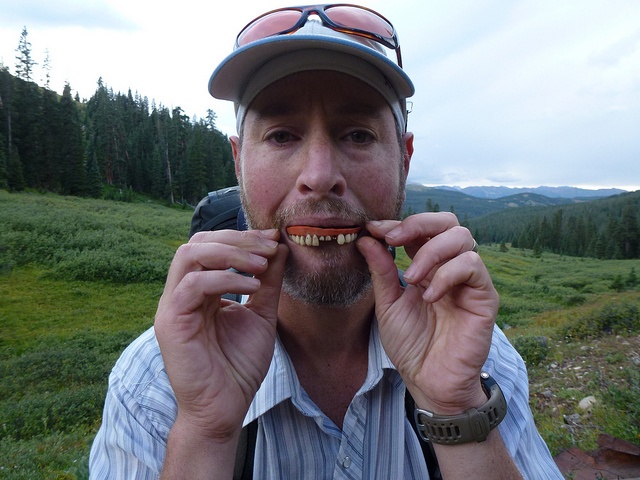 False Teeth