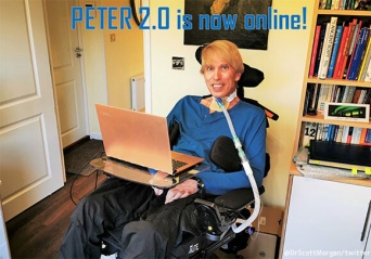 続報：あのロボット科学者が世界初の完全サイボーグ化手術に成功、ピーター2.0がオンラインに